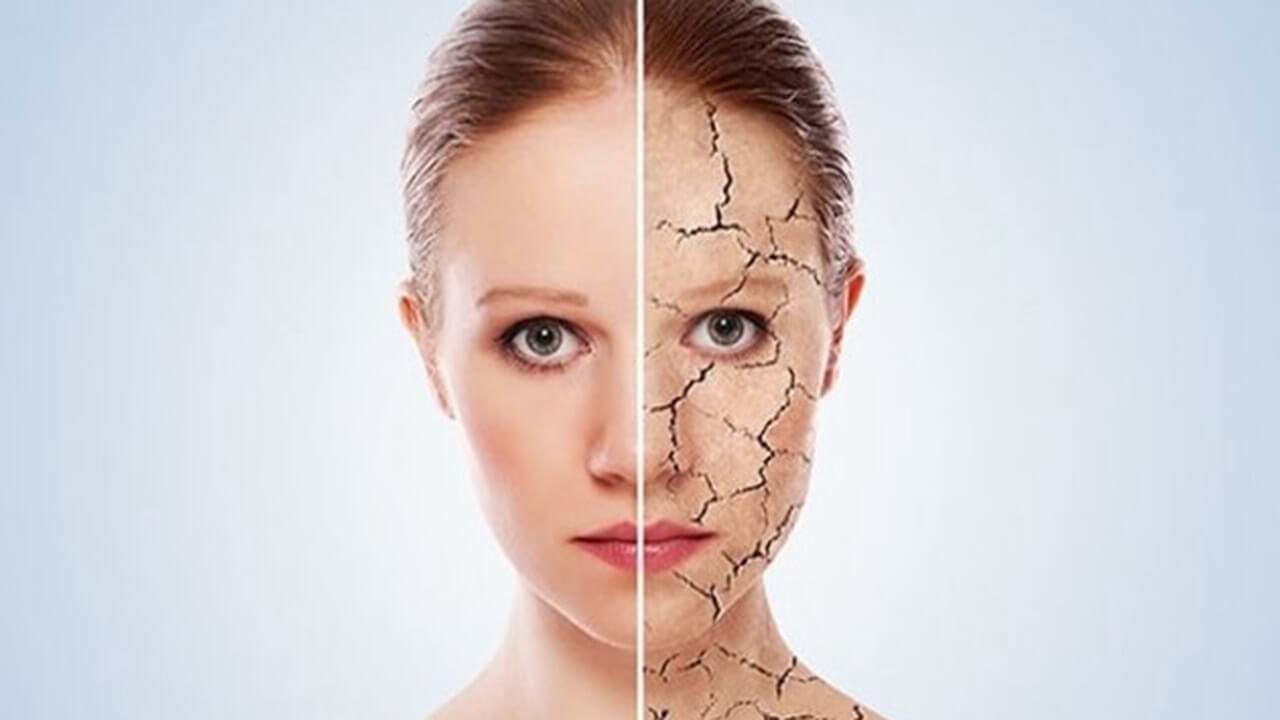 Cilt kuruluğu neden olur? Nasıl önlem alınır?