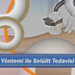 Lazer tedavisi ile anne karnında bebek hayat buldu!
