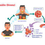 İnsülin Direnci Neden Oluyor? Uzmanlardan Önemli Uyarılar